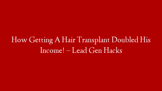 How Getting A Hair Transplant Doubled His Income! – Lead Gen Hacks
